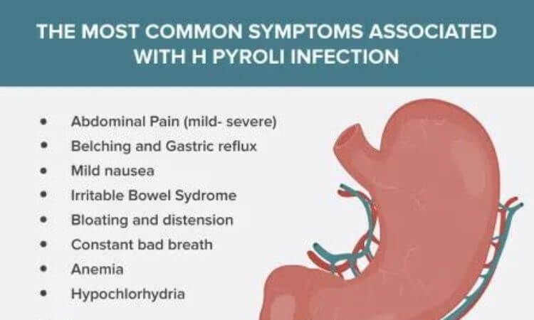 H. pylori Symptoms, Causes, and Treatment