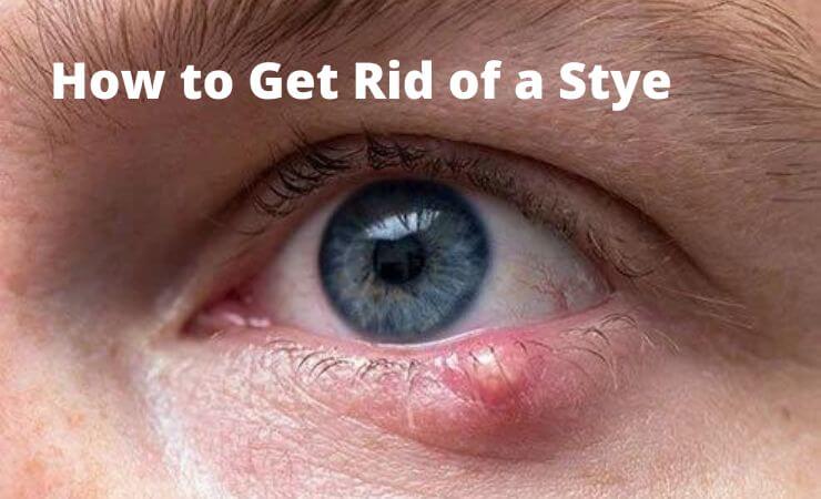 How to Get Rid of a Stye 8 Home Remedies and Treatments