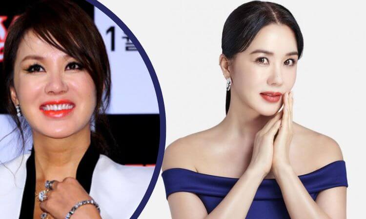 Uhm Jung-hwa Plastic Surgery Before and After Comparison