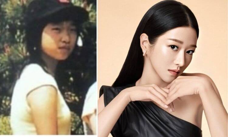 Did Hot Sexy Korean actress Seo Ye Ji get plastic surgery?