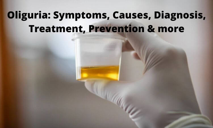 Oliguria Symptoms, Causes, Diagnosis, Treatment, Prevention & more