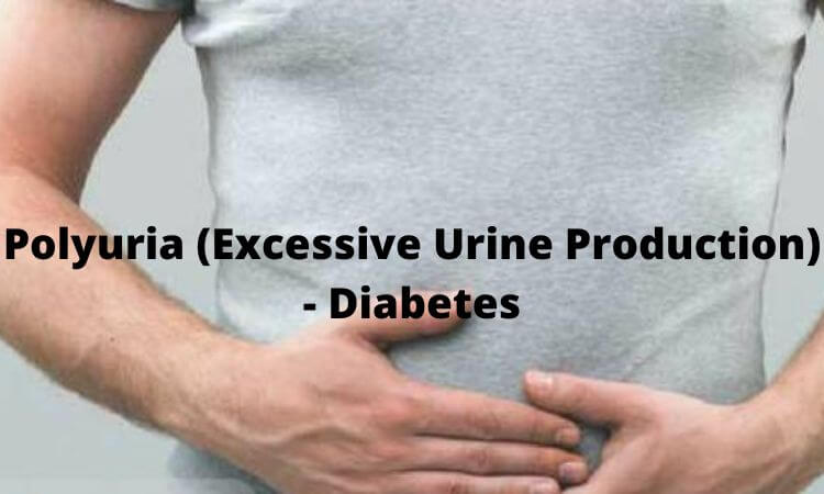 Polyuria (Excessive Urine Production) - Diabetes