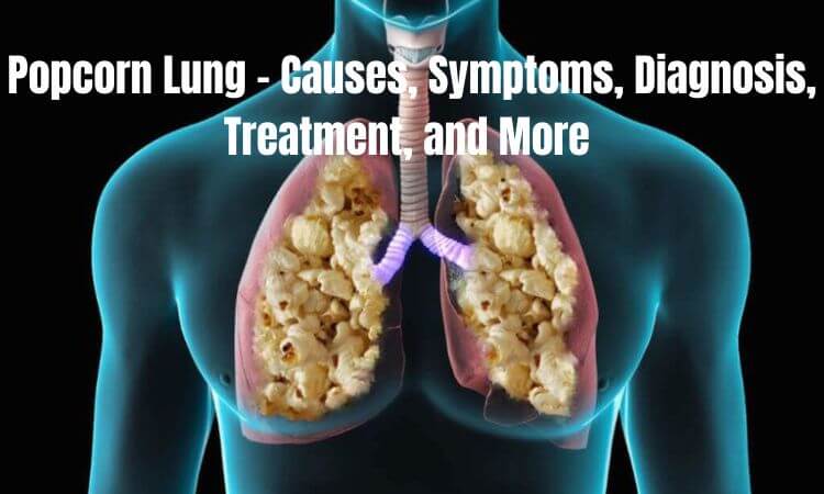 Popcorn Lung – Causes, Symptoms, Diagnosis, Treatment, and More 