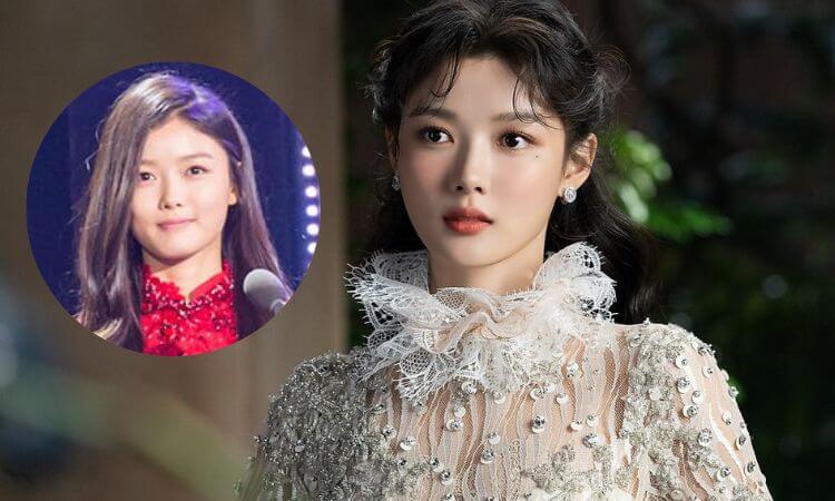 Is it True that Korean Actress Kim Yoo Jung has Plastic Surgery Recently