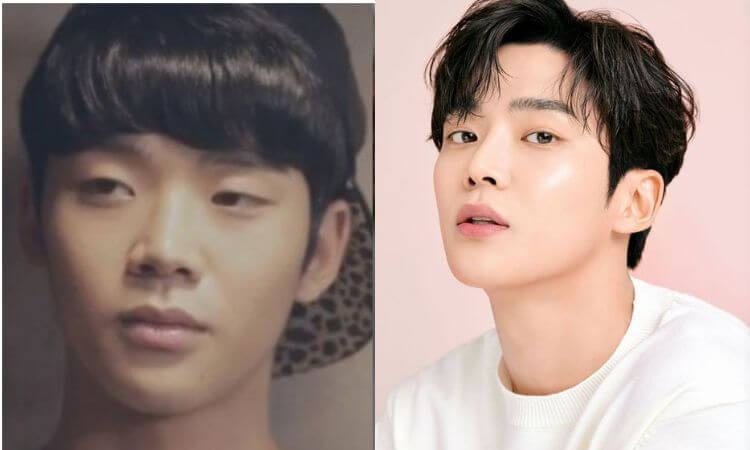 SF9 Rowoon Plastic Surgery Before and After Transformation
