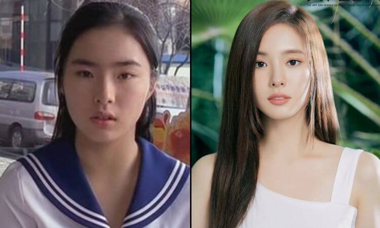 Shin Se Kyung Get Plastic Surgery or Not