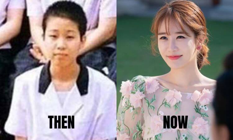 Yoo In Na Plastic Surgery Before and After Transformation